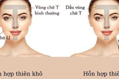 Cách chăm sóc da hỗn hợp