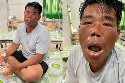 Cứu sống ngư dân sau 4 ngày rơi xuống biển