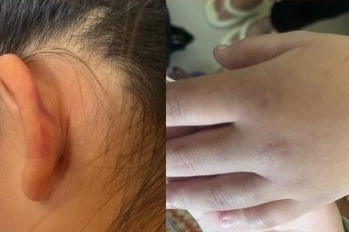 Nhóm thiếu nữ thừa nhận lột đồ, đánh hội đồng bạn suốt 2 giờ