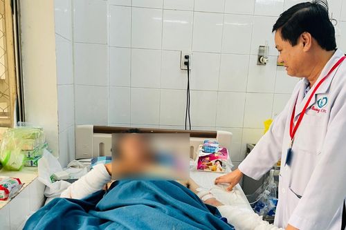 Lán trại bị tẩm xăng đốt, quản lý công trình bỏng nặng