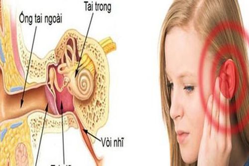 Mùa hè cảnh giác với nhọt ống tai