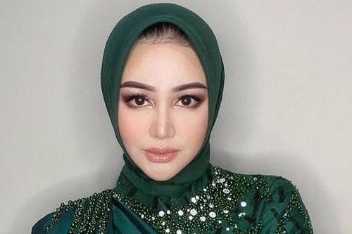 Hoa hậu đẹp nhất Thế giới bị chê xuống sắc