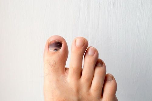 Những dấu hiệu không ngờ cảnh báo ung thư da