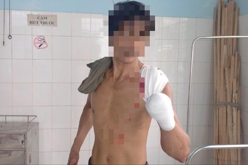 Bà Rịa – Vũng Tàu: Truy bắt ba đối tượng dùng hung khí chém người trọng thương