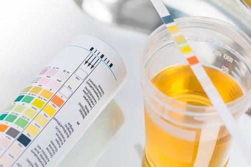 Xét nghiệm nước tiểu và ý nghĩa của các chỉ số
