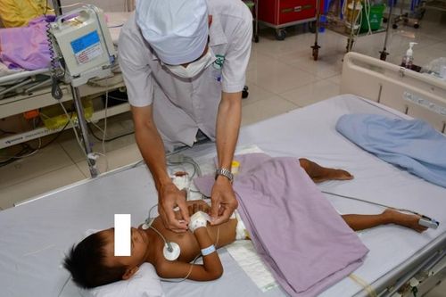 Lấy búi tóc to từ trong ruột bé gái 4 tuổi ở Sóc Trăng