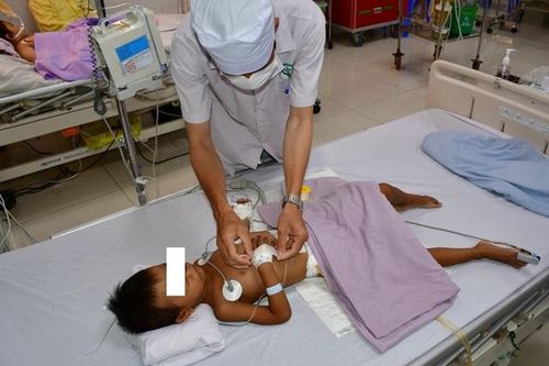 Phẫu thuật cấp cứu cho bé gái 4 tuổi bị tắc ruột do 'ăn tóc'