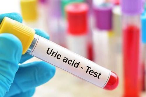 Xét nghiệm acid uric tăng liệu có phải mắc bệnh gout?