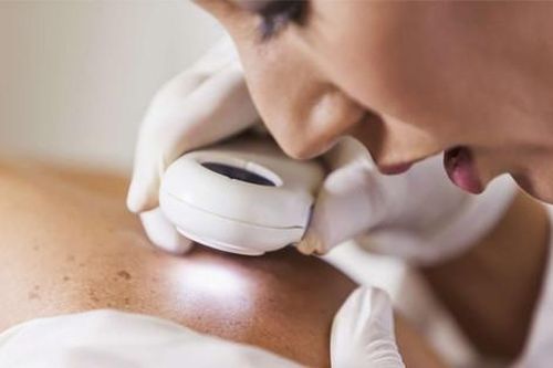 Loại ung thư rất phổ biến nhưng có thể chữa khỏi