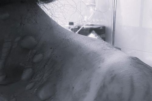 Đang nấu ăn, người phụ nữ phải nhập viện khẩn vì thứ phổ biến trong nhà bếp thường dùng