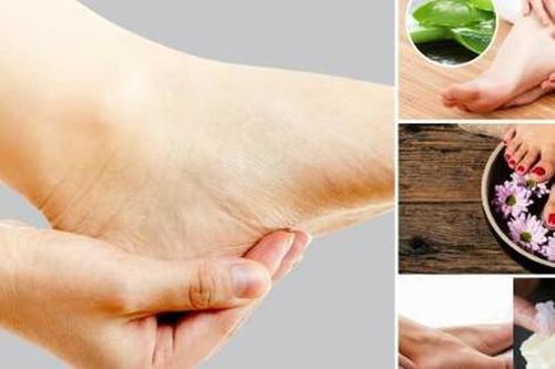 Cách hạn chế nứt gót chân