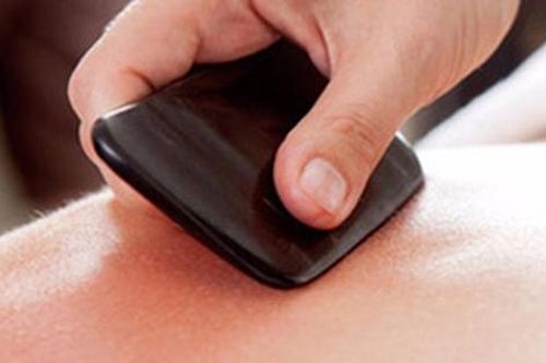 Cạo gió - cách chữa bệnh cổ xưa: 4 lưu ý không phải ai cũng biết