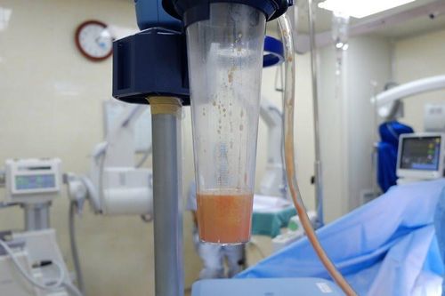 Nhập viện cấp cứu sau khi hút mỡ tại Bệnh viện chuyên khoa Thẩm mỹ Đông Á
