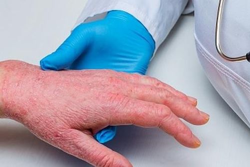 Phòng ngừa và xử trí dị ứng thức ăn