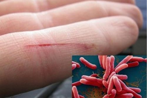 Đắk Lắk: Nâng cao ý thức phòng bệnh Whitmore và các bệnh truyền nhiễm
