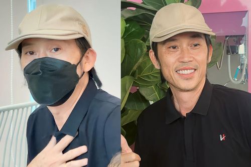 Hoài Linh lộ diện tươi tắn, tiết lộ tình hình sức khỏe sau loạt biến cố