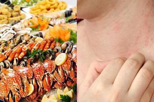Một người bất ngờ tử vong sau khi ăn cua biển, cần làm gì để phòng ngừa ngộ độc hải sản?