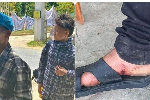 Hai người đi bộ gần 30km, chân rướm máu được công an, người dân Nghệ An hỗ trợ