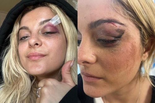 Bebe Rexha gặp xui: Bị fan cuồng ném điện thoại vào đầu, vé concert rẻ bèo chỉ 1 đôla