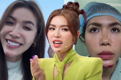 Minh Tú trải lòng sau khi gặp tai nạn ghi hình, khâu hơn 10 mũi