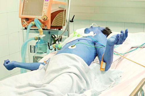 Nguy kịch tính mạng vì coi thường vết thương nhỏ ở bàn chân