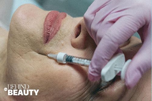 Sự thật về tiêm filler