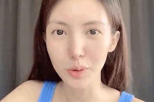 Kim Thần bị lệch miệng vì phẫu thuật thẩm mỹ quá đà