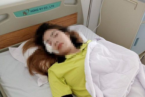 Hai vợ chồng ngã xe trọng thương do bị chó dữ đuổi cắn trong khu công nghiệp