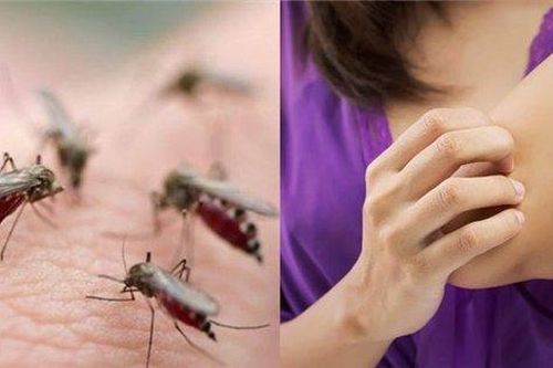 Vì sao cùng ở một điểm người bị muỗi đốt người lại không?