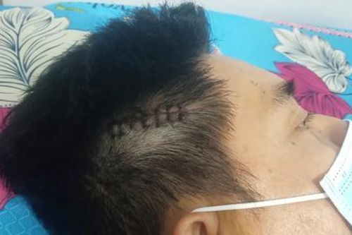 Công an huyện Củ Chi điều tra vụ chủ nhà trọ bị chém