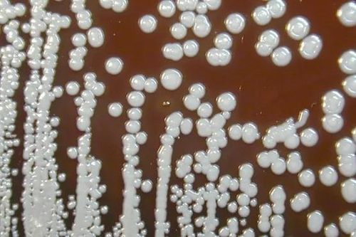 Mỹ cảnh báo sự lây lan của vi khuẩn gây bệnh Whitmore