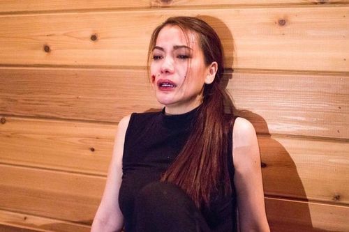 Diễn viên Trương Ngọc Ánh: Tôi bị đấm muốn mù một bên mắt!