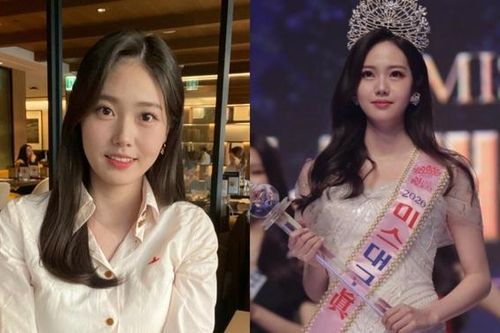 Những hình ảnh cuối đời của Hoa hậu mất sau ca phẫu thuật ở tuổi 26