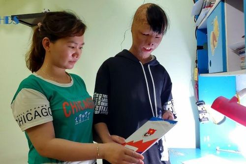 Niềm vui vào lớp 10 của cậu bé 'đuốc sống'