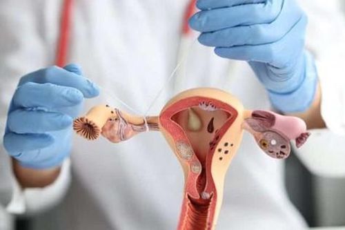 Cắt bỏ ống dẫn trứng có thể giảm nguy cơ ung thư buồng trứng?