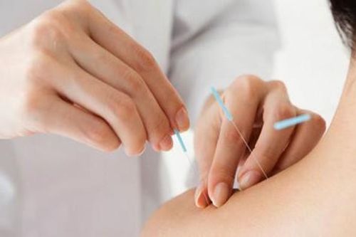 Châm cứu, bấm huyệt có chữa được bệnh hen?