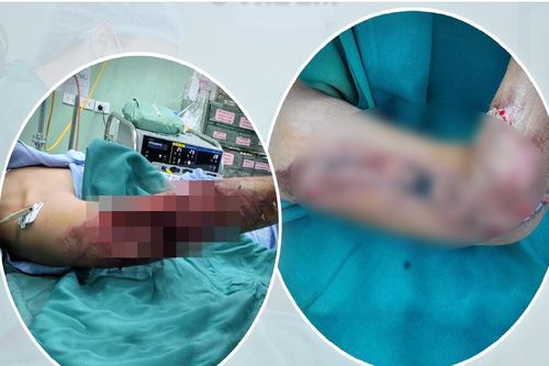 Cảnh giác với những chiếc áo chống nắng