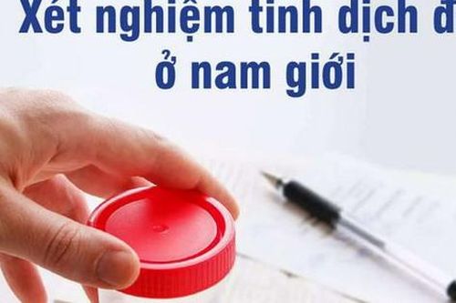 Ý nghĩa các chỉ số của xét nghiệm tinh dịch đồ khi chẩn đoán vô sinh