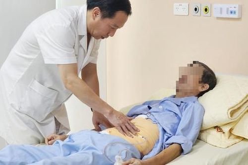 Lấy thành công khối u khổng lồ chèn ép toàn bộ khoang bụng nam bệnh nhân