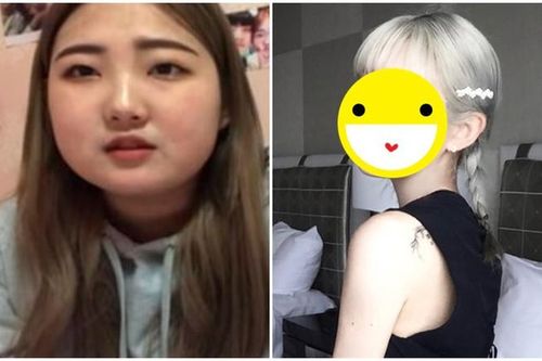 Diện mạo bất ngờ của cô gái giảm hơn 50kg và trải qua 2 lần 'dao kéo'