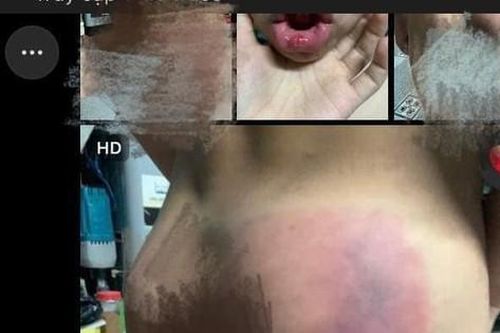 Cô giáo dạy thêm bị tố đánh học sinh chảy máu miệng, sưng đầu