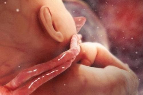 Điều mẹ bầu nên làm khi phát hiện 'tràng hoa quấn cổ' em bé