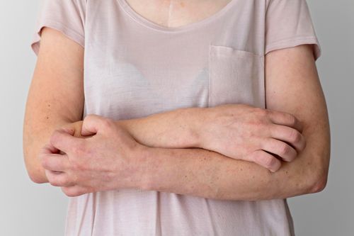 Những triệu chứng tăng dần ở người bị dị ứng đồ ăn