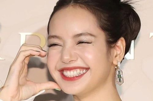 Rủi ro khi gắn đá lên răng giống Lisa (BlackPink)