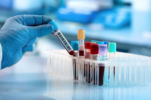Xét nghiệm tổng quát là gì?
