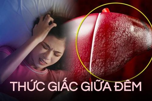 Tỉnh giấc lúc 3-4 giờ sáng: Bác sĩ cảnh báo có thể 2 cơ quan nội tạng đã bị tổn thương