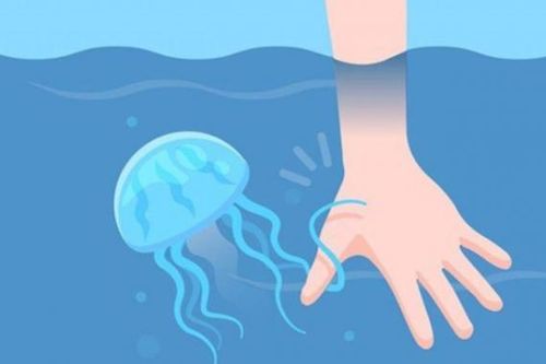Cách cấp cứu khi đi biển bị sứa 'cắn'