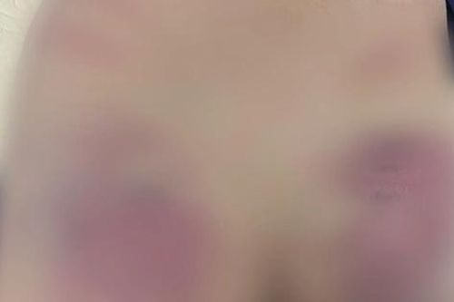 Bé trai tự kỷ nghi bị bạo hành: Điểm dạy trẻ không có giấy phép, cô giáo từng muốn bồi thường 6 tháng học phí
