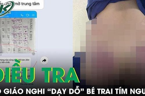 Vụ cháu bé chậm phát triển bị 'dạy dỗ' tím người: Cô giáo thuê căn hộ, dạy tự phát