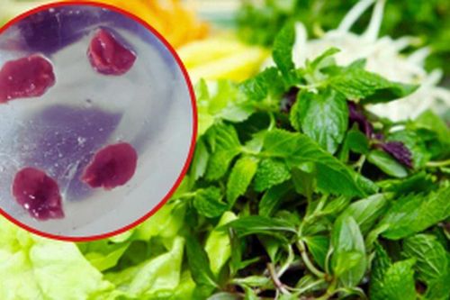 Cô gái trẻ có 7 loại giun sán ký sinh trong người vì mê loại rau mà nhiều người Việt ưa thích